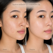 Sérum Cica PDRN Pink Peptídeo Allegra 30ml, registro de pele antes e depois